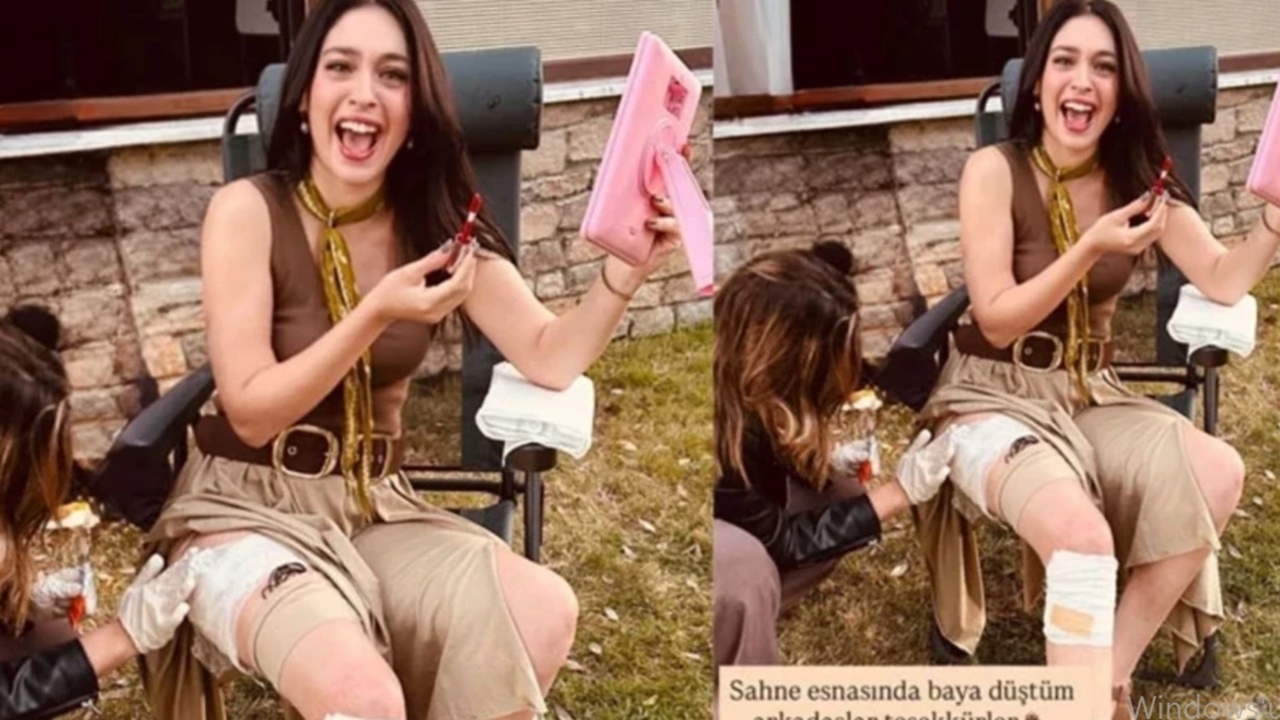 Güzel oyuncu Cemre Baysel yeni dizisinin setinde kaza geçirdi